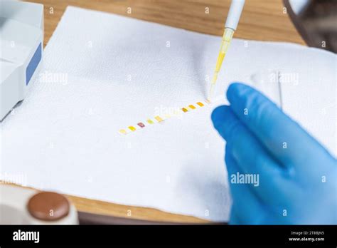 dropping urine strip test with pipette|how to read urine test strip.